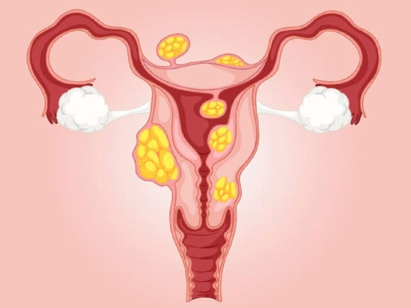uterus